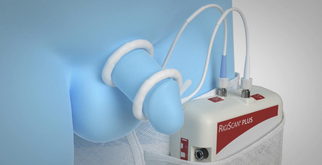 性功能仪器怎么检测想判断丁丁是否“坚挺”，这个仪器您有必要了解一下_https://www.jmylbn.com_新闻资讯_第4张