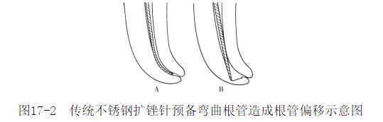 为什么要用根管马达（第122期）根管预备新技术_https://www.jmylbn.com_新闻资讯_第2张