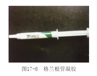 为什么要用根管马达（第122期）根管预备新技术_https://www.jmylbn.com_新闻资讯_第6张