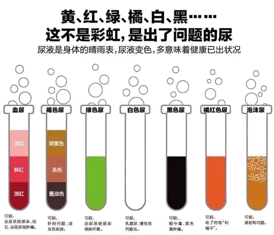 导尿袋有哪些型号护士请收藏！关于导尿，这些问题你都掌握了吗？_https://www.jmylbn.com_新闻资讯_第19张