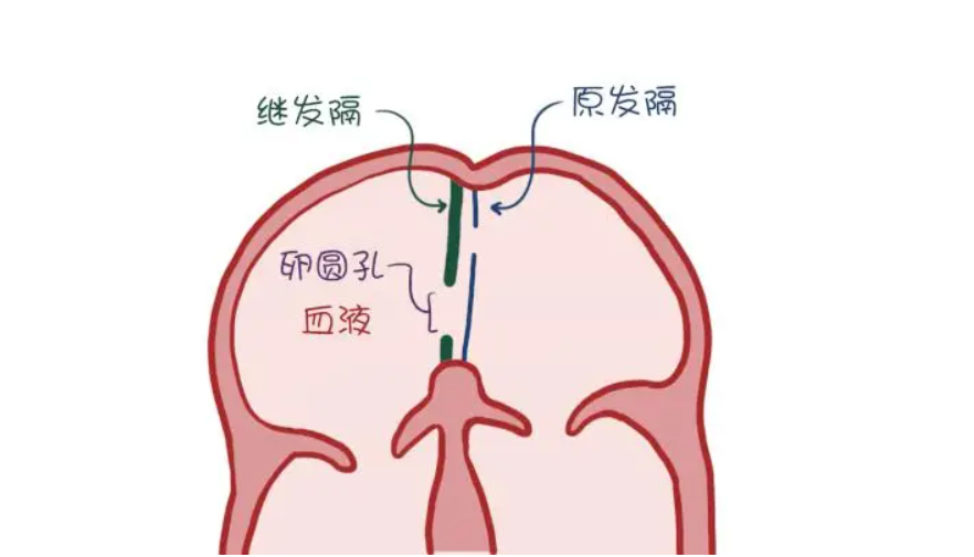 卵圆孔是胚胎时期心脏房间隔的一个生理性通道