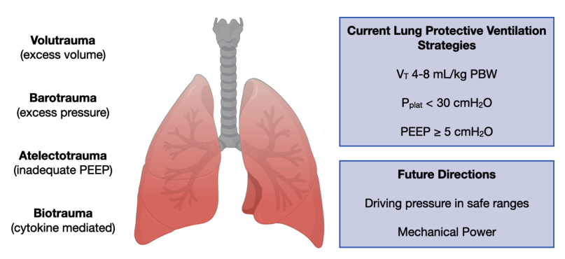 呼吸机vt是什么意思了解呼吸机诱导的肺损伤：机械功的作用_https://www.jmylbn.com_新闻资讯_第7张