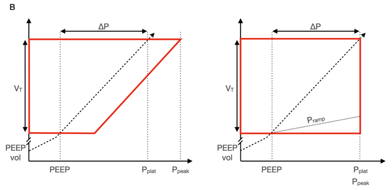呼吸机vt是什么意思了解呼吸机诱导的肺损伤：机械功的作用_https://www.jmylbn.com_新闻资讯_第4张
