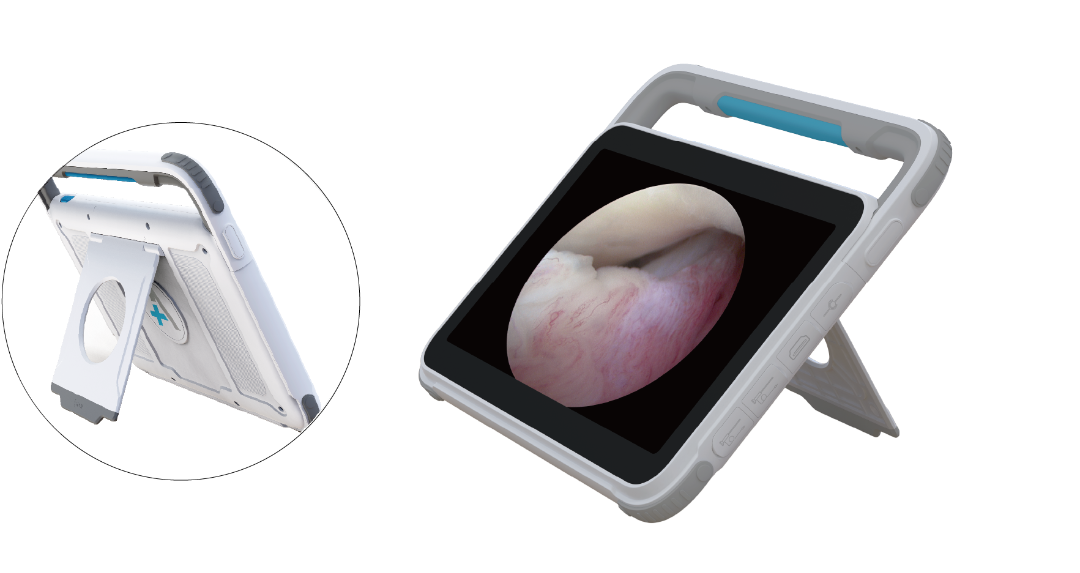 序号3 便携式电子内窥镜图像处理器 1.png