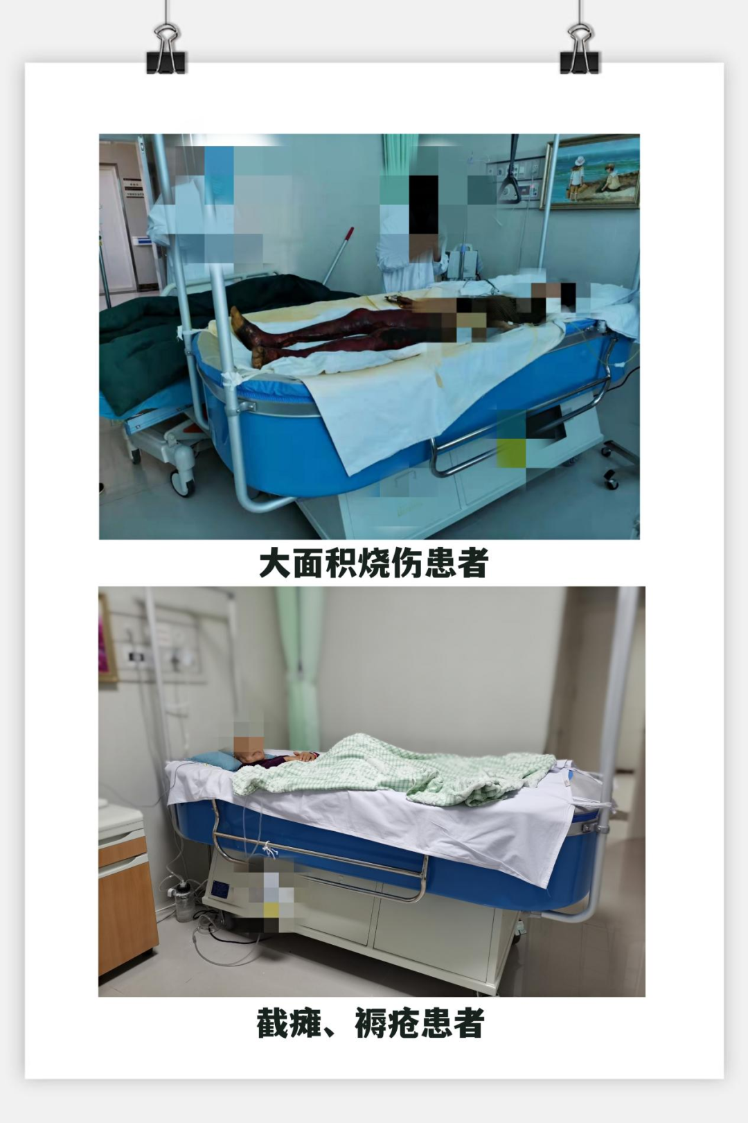 治疗床怎么用您了解流体悬浮治疗床吗？流体悬浮治疗床不仅仅用于大面积烧伤患者，还可以用于..._https://www.jmylbn.com_新闻资讯_第11张