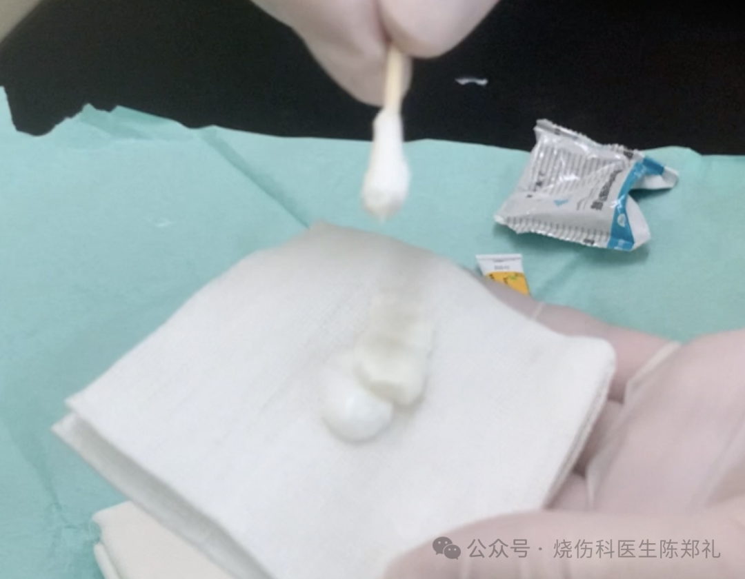 烧伤敷料怎么用图解创面外用药物及敷料系列丨油性药膏的原理及注意事项_https://www.jmylbn.com_新闻资讯_第9张