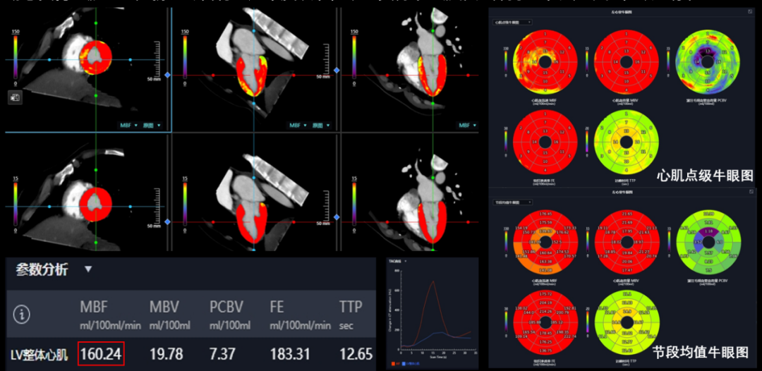 联影有哪些CT【影领未来】精准所见，安全所托！我院联影uCT 968高端CT 正式 “上岗”_https://www.jmylbn.com_新闻资讯_第7张