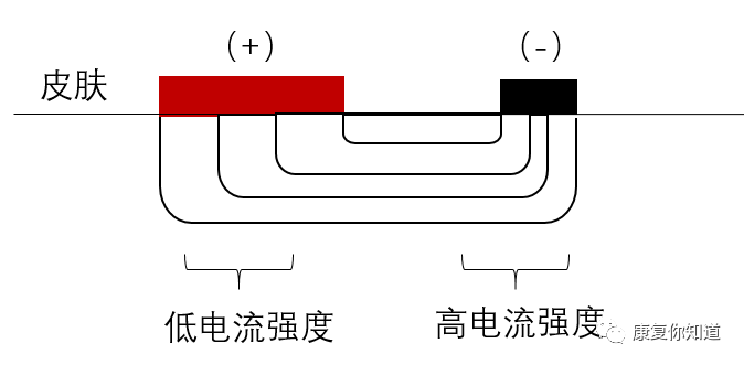 中频为什么能镇痛许多理疗馆用的中频电疗法的治疗作用和用法~~~_https://www.jmylbn.com_新闻资讯_第9张