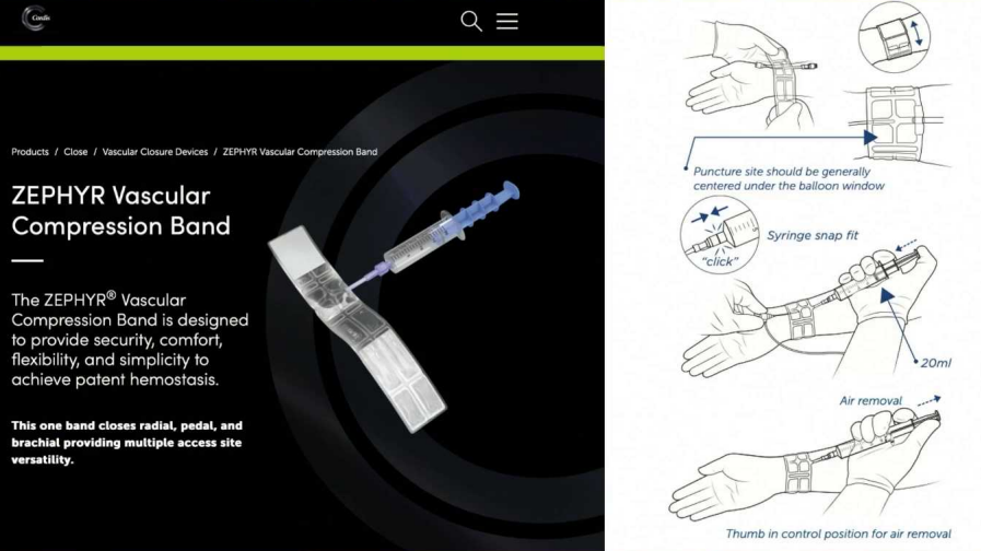 动脉长鞘怎么置入桡胜一筹丨原口拓也：经桡动脉入路在下肢动脉疾病腔内治疗中的优势——RADIANZ应用经验_https://www.jmylbn.com_新闻资讯_第19张