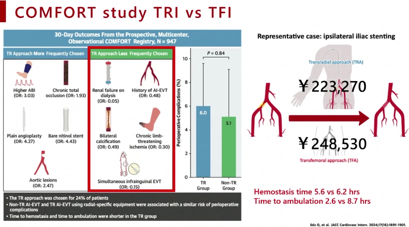 动脉长鞘怎么置入桡胜一筹丨原口拓也：经桡动脉入路在下肢动脉疾病腔内治疗中的优势——RADIANZ应用经验_https://www.jmylbn.com_新闻资讯_第9张