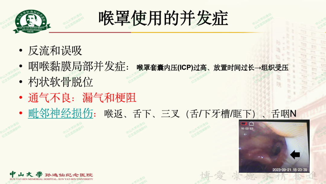 为什么要用喉罩浅谈喉罩的临床应用_https://www.jmylbn.com_新闻资讯_第23张