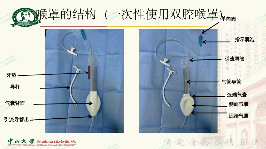 为什么要用喉罩浅谈喉罩的临床应用_https://www.jmylbn.com_新闻资讯_第5张