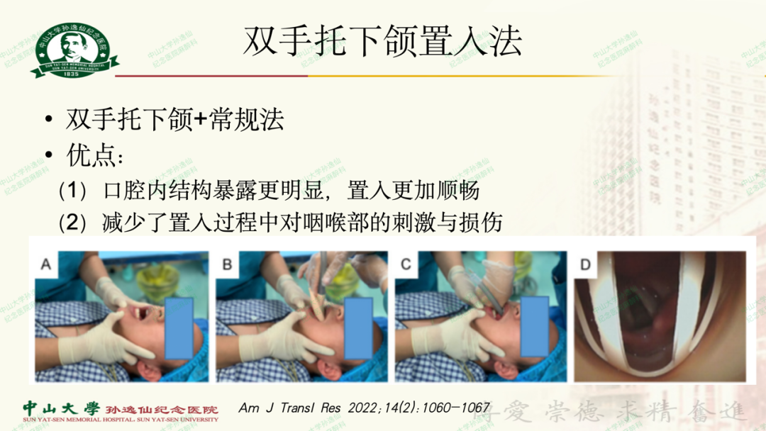 为什么要用喉罩浅谈喉罩的临床应用_https://www.jmylbn.com_新闻资讯_第16张