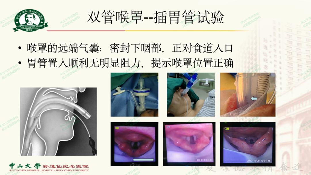 为什么要用喉罩浅谈喉罩的临床应用_https://www.jmylbn.com_新闻资讯_第19张