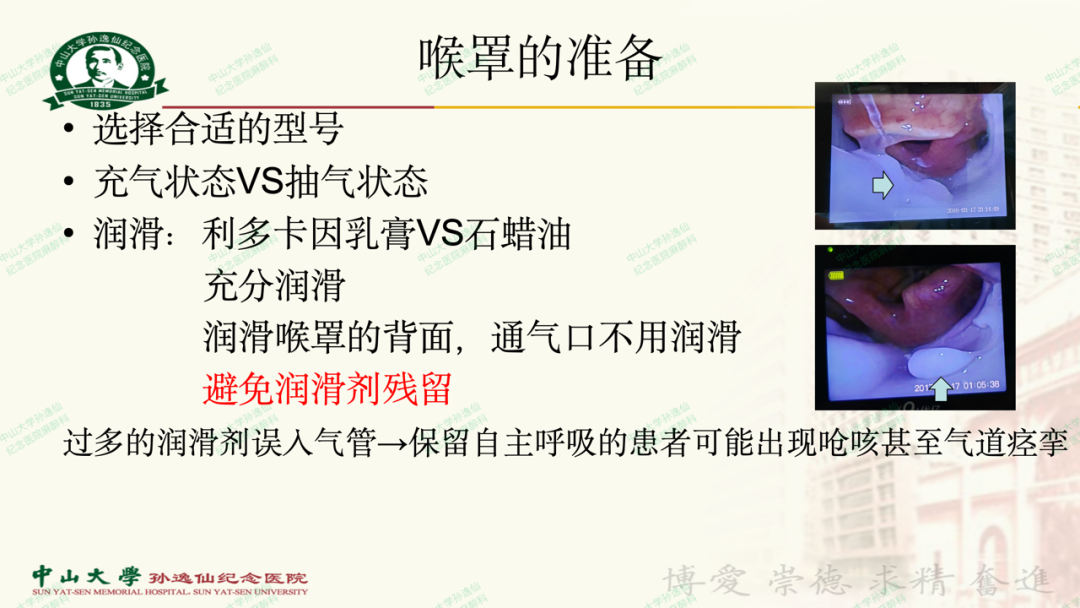 为什么要用喉罩浅谈喉罩的临床应用_https://www.jmylbn.com_新闻资讯_第13张