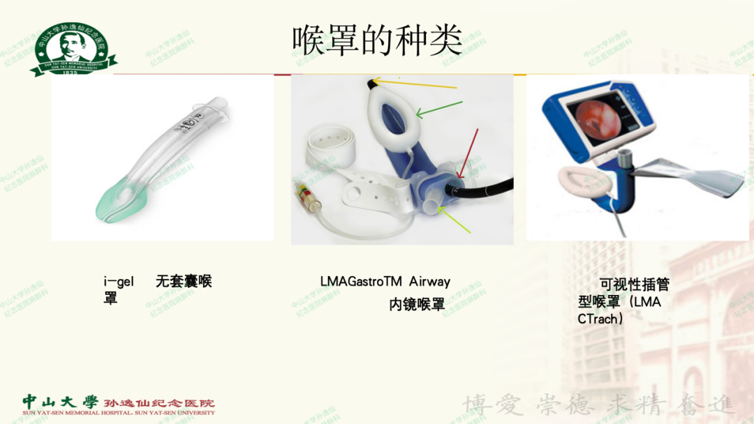 为什么要用喉罩浅谈喉罩的临床应用_https://www.jmylbn.com_新闻资讯_第9张