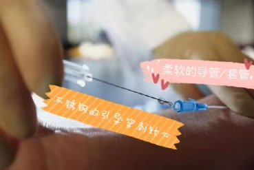 为什么输血不能用小针关于“留置针”的小秘密_https://www.jmylbn.com_新闻资讯_第2张