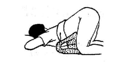 检查指套怎么弄肛门指检可以自己做吗？_https://www.jmylbn.com_新闻资讯_第7张