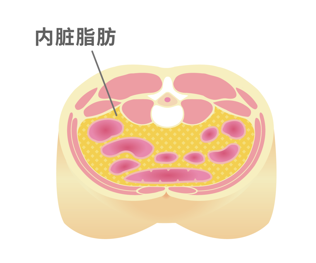 減肥手術(shù)多少錢_減肥手術(shù)哪種效果好_手術(shù)減肥