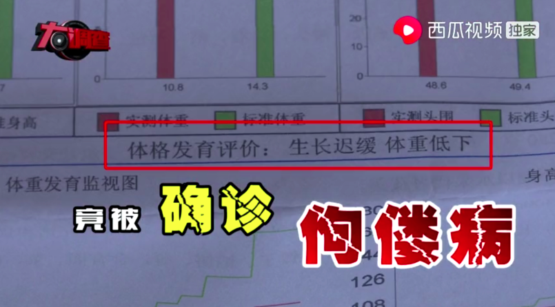 起紅疹、佝僂病、發育停止...湖南出現多名大頭娃娃 只因喝了這款「毒奶粉」 親子 第6張