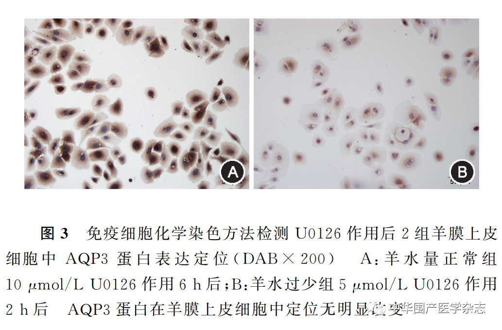 上皮细胞用什么染色温故知新｜水通道蛋白3在人羊膜上皮细胞中的 表达及调控_https://www.jmylbn.com_新闻资讯_第6张