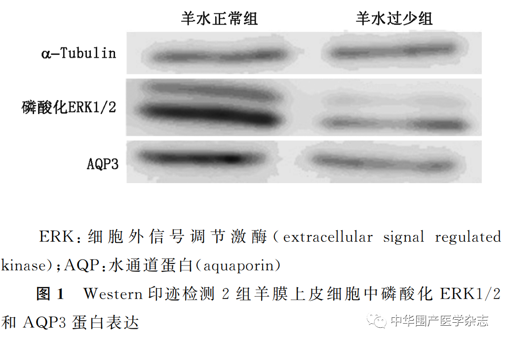 上皮细胞用什么染色温故知新｜水通道蛋白3在人羊膜上皮细胞中的 表达及调控_https://www.jmylbn.com_新闻资讯_第2张