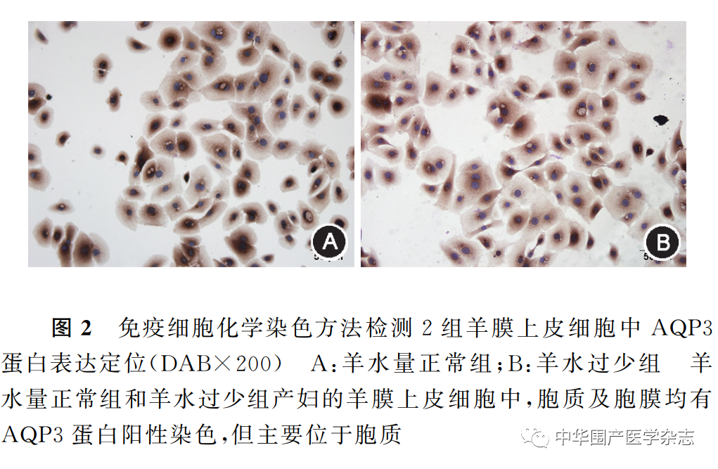 上皮细胞用什么染色温故知新｜水通道蛋白3在人羊膜上皮细胞中的 表达及调控_https://www.jmylbn.com_新闻资讯_第5张