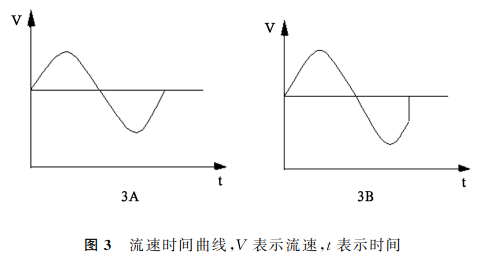 呼吸机pip是什么意思温故知新​｜呼吸机波形在呼吸机调节中的应用_https://www.jmylbn.com_新闻资讯_第3张