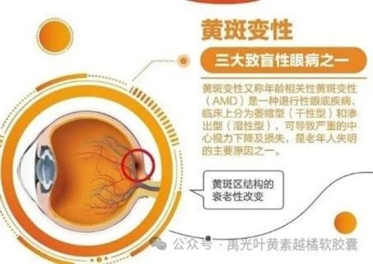 凝胶眼贴怎么用⑧叶黄素水凝胶眼贴膜 ｜轻松一贴，享受新“视界”_https://www.jmylbn.com_新闻资讯_第8张