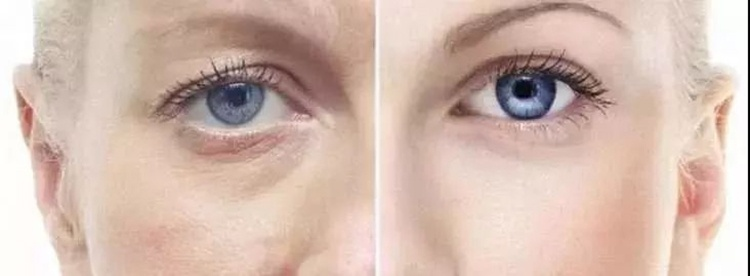 凝胶眼贴怎么用⑧叶黄素水凝胶眼贴膜 ｜轻松一贴，享受新“视界”_https://www.jmylbn.com_新闻资讯_第24张