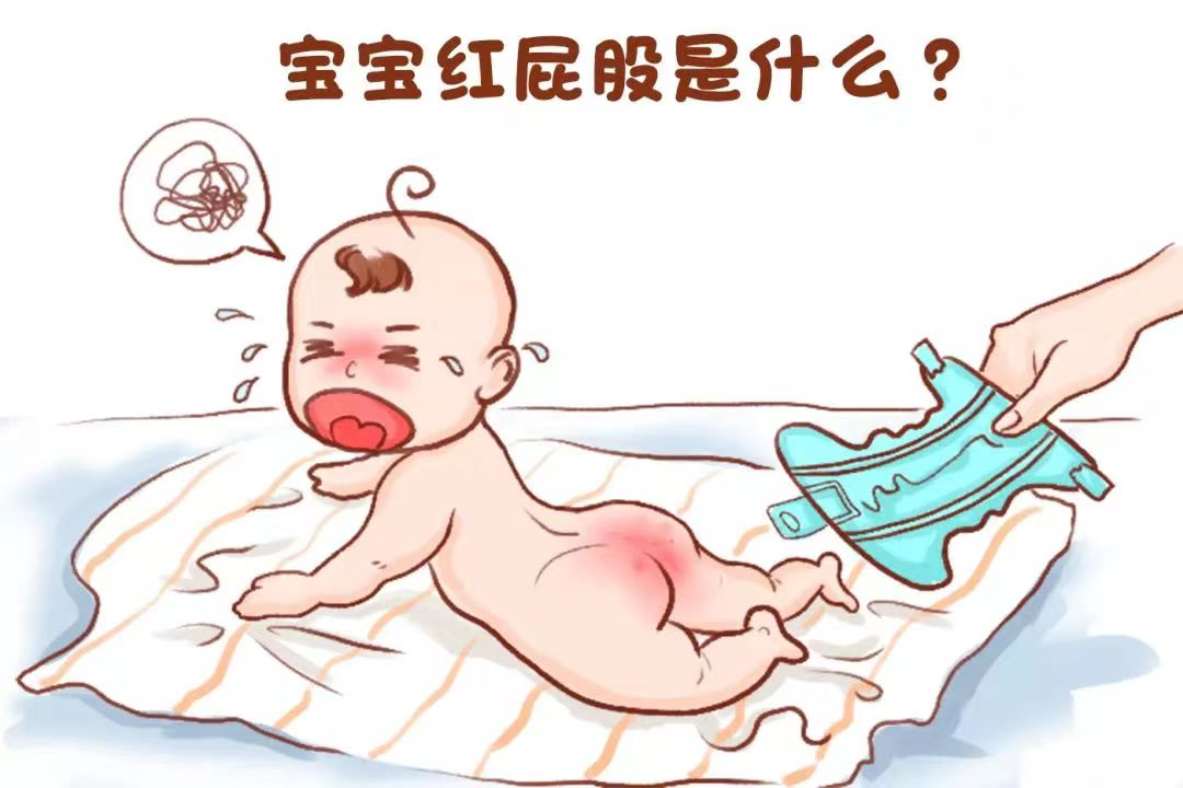 如何预防与护理新生儿红臀?