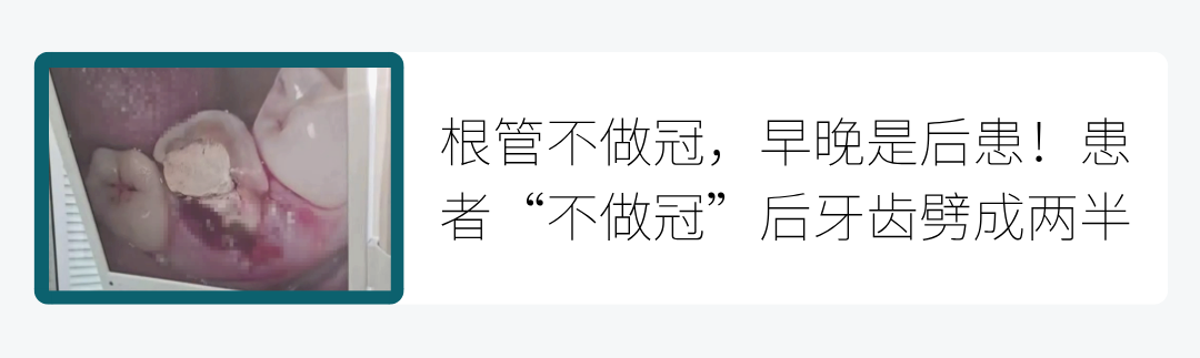 激光和电刀区别是什么重磅利好！口腔显微、激光、微动力、电刀、机器人等技术正式合规收费_https://www.jmylbn.com_新闻资讯_第13张