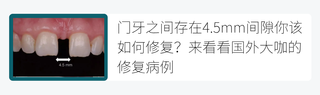激光和电刀区别是什么重磅利好！口腔显微、激光、微动力、电刀、机器人等技术正式合规收费_https://www.jmylbn.com_新闻资讯_第14张