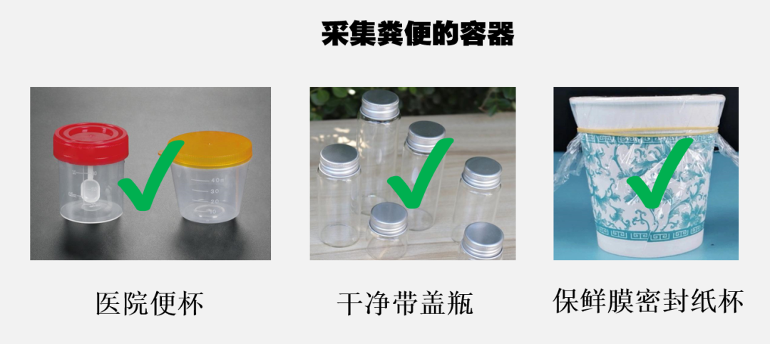 化验大便怎么采集如何淡定、优雅地采集粪便标本，你真的会吗？_https://www.jmylbn.com_新闻资讯_第10张
