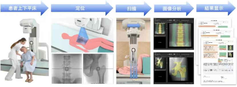 骨密度bmd是什么四川省妇幼保健院放射科新项目—骨密度影像技术（BMD）_https://www.jmylbn.com_新闻资讯_第2张