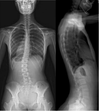 骨密度bmd是什么四川省妇幼保健院放射科新项目—骨密度影像技术（BMD）_https://www.jmylbn.com_新闻资讯_第4张