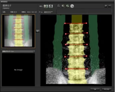 骨密度bmd是什么四川省妇幼保健院放射科新项目—骨密度影像技术（BMD）_https://www.jmylbn.com_新闻资讯_第8张