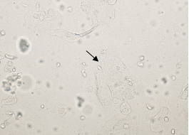 bv唾液酸酶阴性什么意思学术前沿 ｜ 加德纳菌一定会产生唾液酸苷酶吗？_https://www.jmylbn.com_新闻资讯_第2张