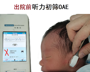 听力筛查仪器怎么看全国爱耳日必看，新生儿听力筛查全解析_https://www.jmylbn.com_新闻资讯_第4张