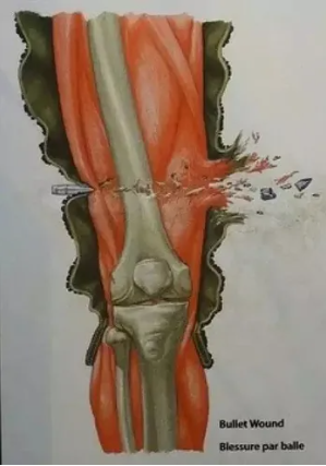 一颗青木：99%的美国枪击案，中国媒体都拒绝报道|2023-11-02-汉风1918-汉唐归来-惟有中华