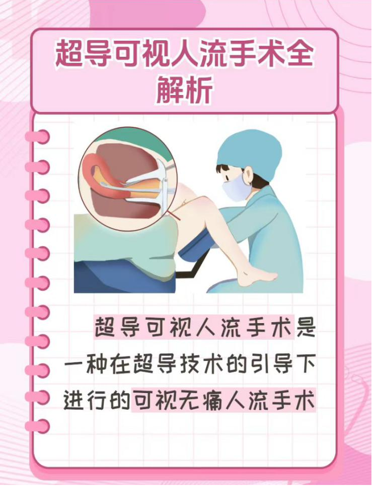 超声引导人流是什么意外怀孕怎么办？——了解一下超声引导可视人流_https://www.jmylbn.com_新闻资讯_第4张