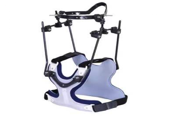 什么是外固定架骨科成功开展颈部寰椎骨折Halo架外固定技术_https://www.jmylbn.com_新闻资讯_第1张