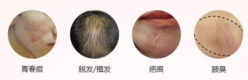 一键识别皮肤病图片，100种皮肤病对照图症状大全