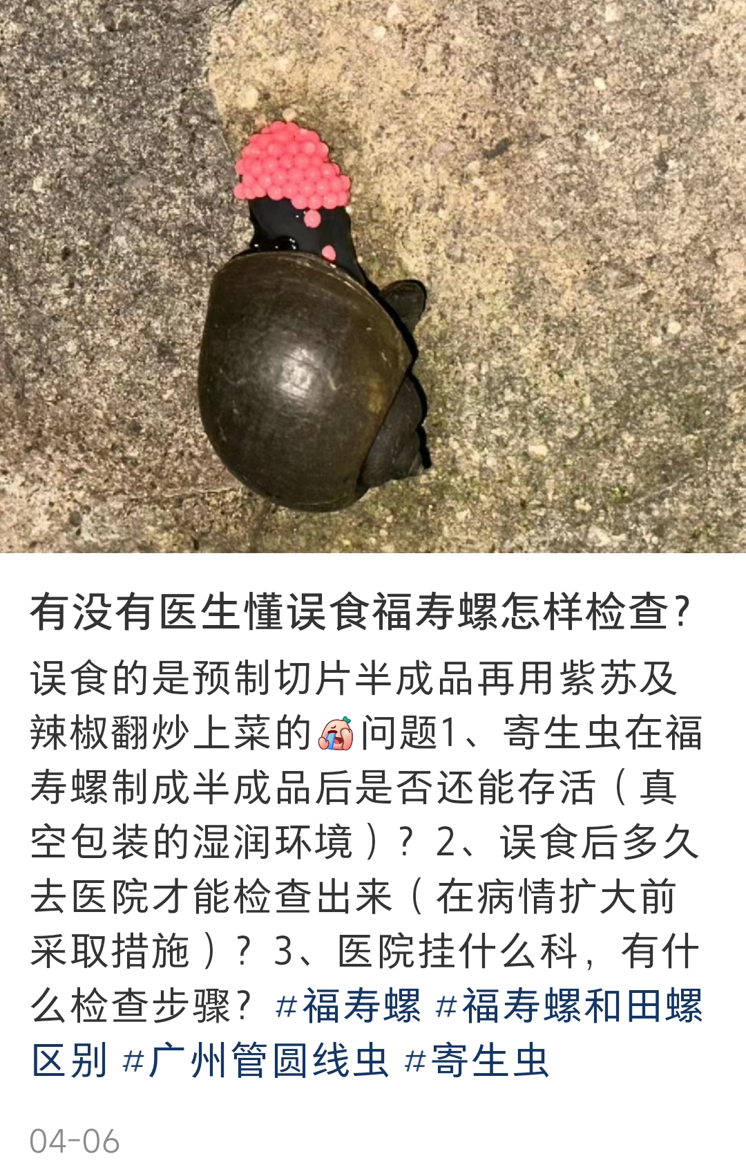 夫妻不戴手套铲除福寿螺感染寄生虫