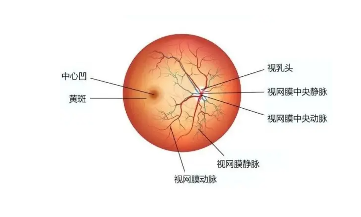 眼底照相能检查出什么一张眼底照片，竟能发现这么多眼病！_https://www.jmylbn.com_新闻资讯_第28张