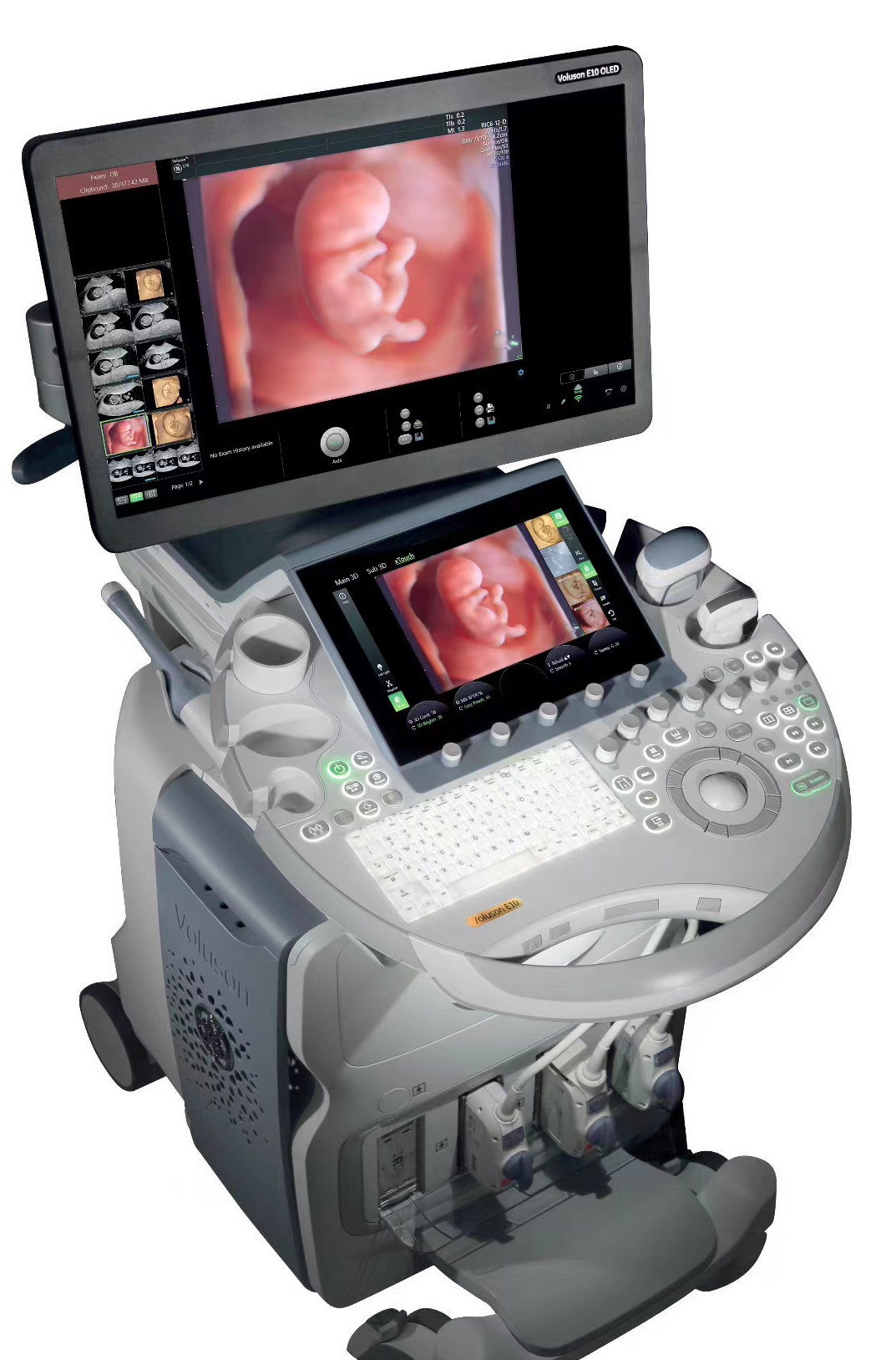 VOlusonE什么彩超机【重磅消息】准妈妈的福音！美国GE Voluson E10彩超进驻柳州二空医院啦！_https://www.jmylbn.com_新闻资讯_第2张