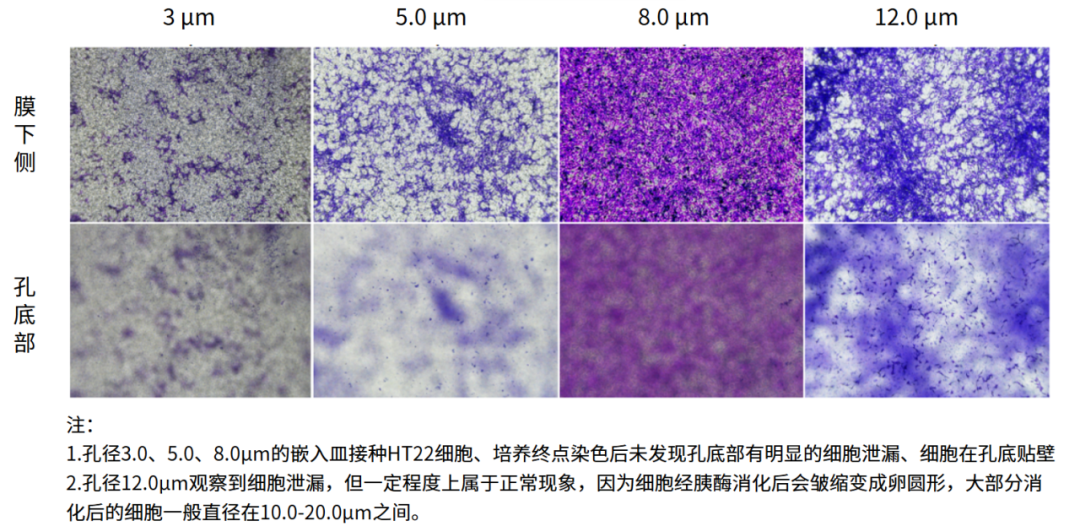 干貨來襲 | 如何用細胞嵌入皿玩轉細胞遷移/侵襲實驗！