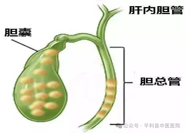 狼牌胆道镜怎么装“镜”无止境，平利县中医医院外二科新开展腹腔镜联合胆道镜下胆囊切除术+胆总管微创取石术_https://www.jmylbn.com_新闻资讯_第3张