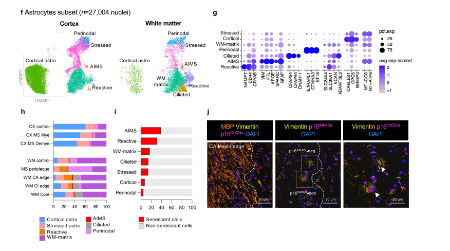 Nature Communications | (2025)类器官与炎症因子诱导类衰老