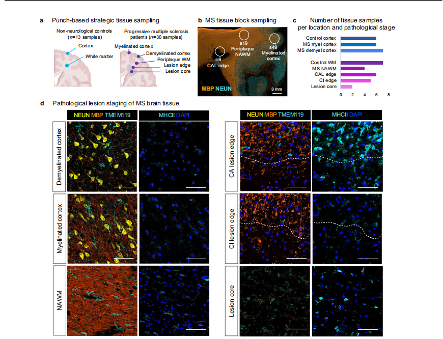 Nature Communications | (2025)类器官与炎症因子诱导类衰老